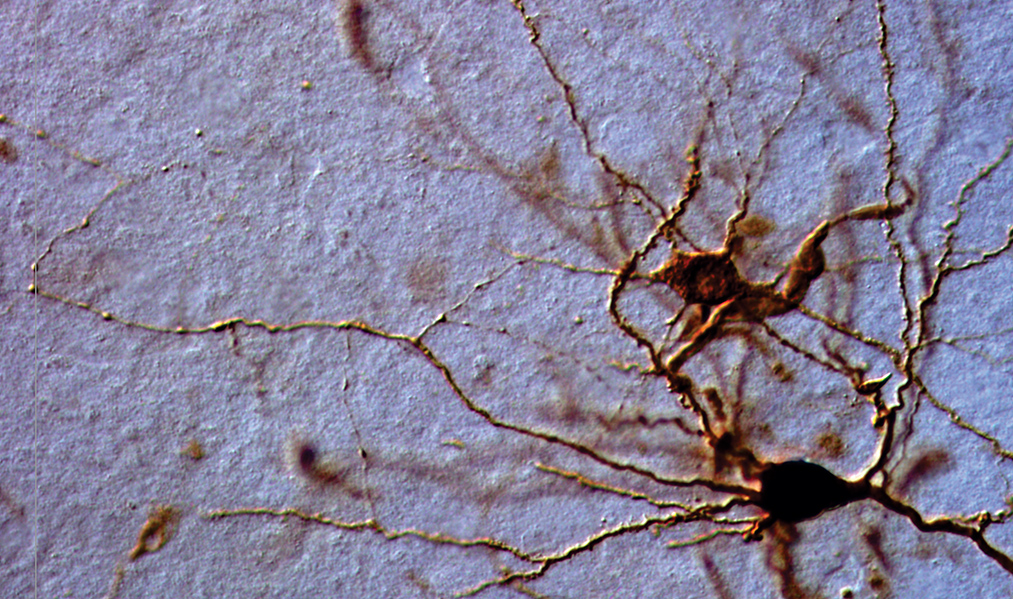 Gold-stained neuron dendrites