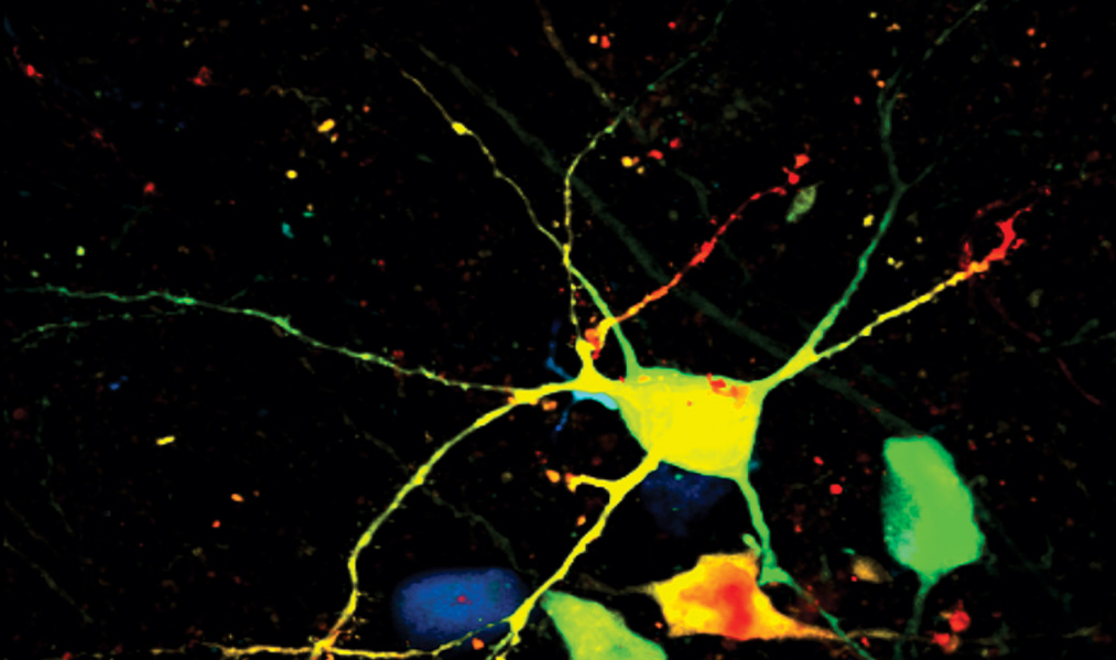 Multicolor fluorescence microscopy of neurons