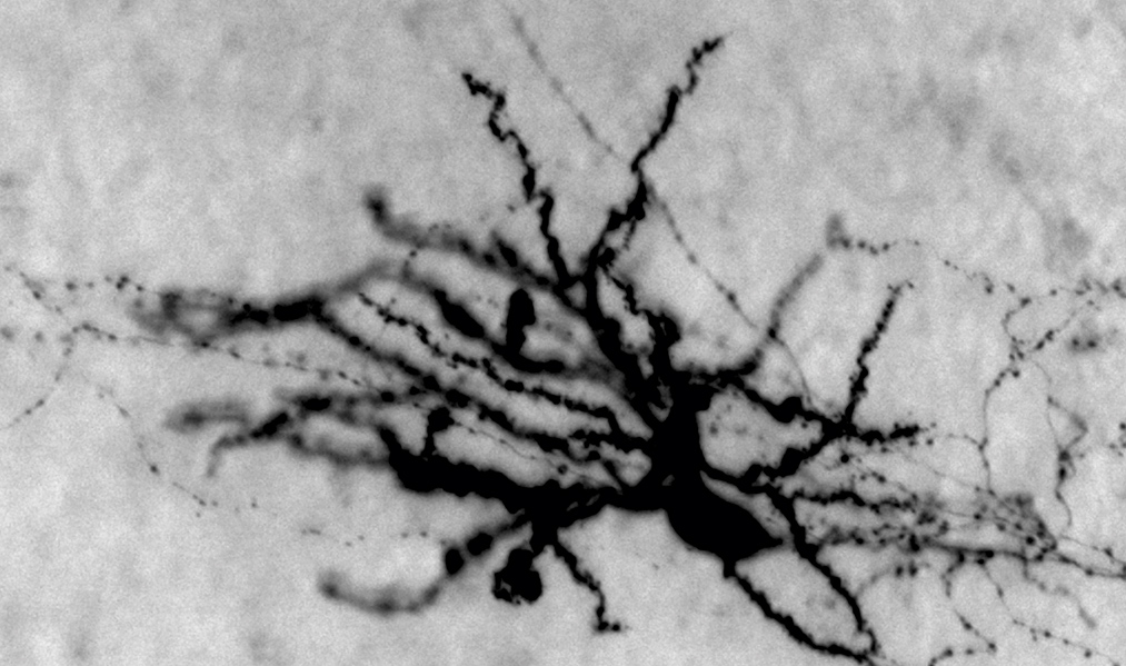 Neurons labeled with red and blue fluorescence